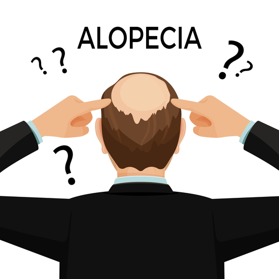 Alopecia doctors